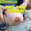 Pus_and_Scabs_